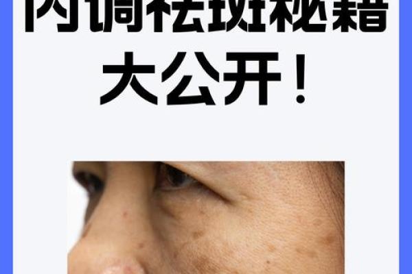 一招祛痣变美，让你的肌肤重焕光彩