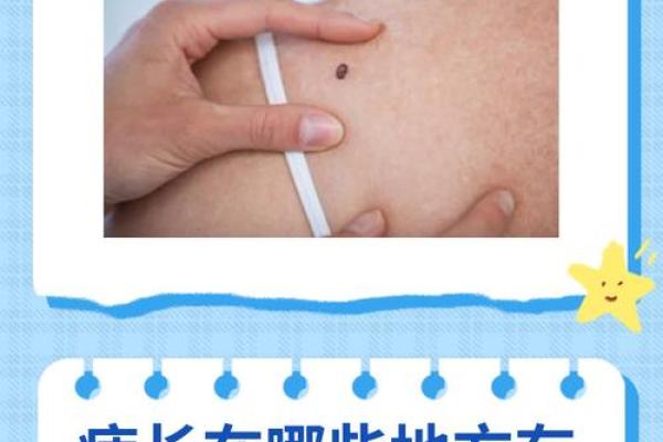 乳房痣相学：上痣下痣揭示你的命运之谜